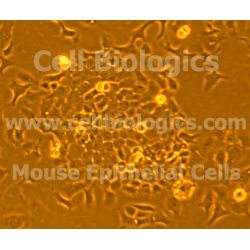 C57BL/6-GFP Mouse Primary Alveolar Epithelial Cells